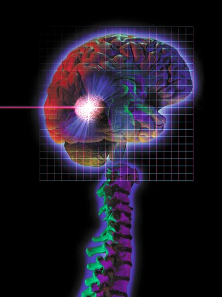 Radiocirurgia — Fotografia de Stock