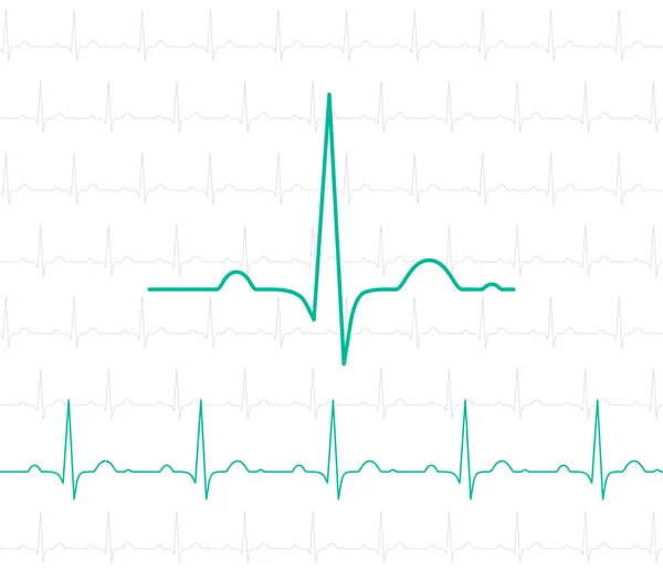 EKG sembolü beyaz - vektör tıbbi geçmişi