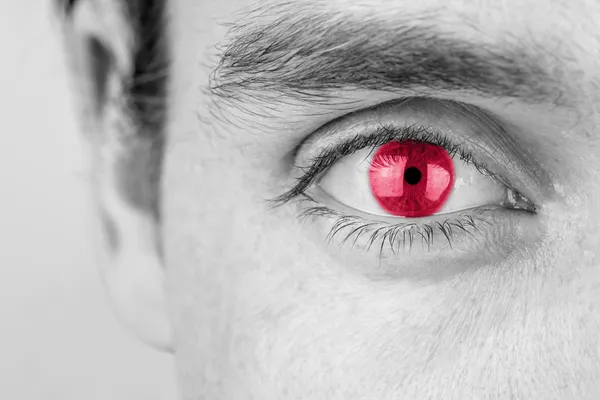 Людина з червоним оком — стокове фото