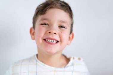 Portrait of a cute boy smiling with white healthy teeth. Emotions of a child