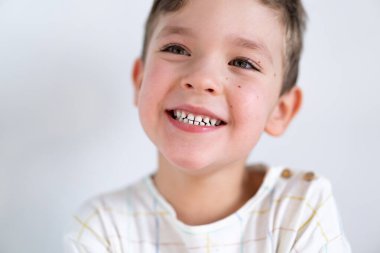 Portrait of a cute boy smiling with white healthy teeth. Emotions of a child