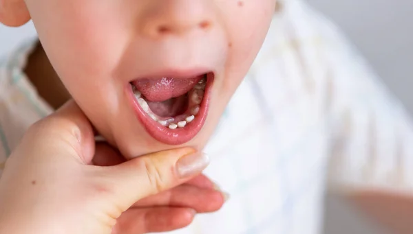 Дети акулы зубы, первый зуб, который появляется в детстве за молочные зубы . — стоковое фото