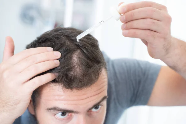 Muž Dělá Ošetření Vypadávání Vlasů Jako Ranní Rutina — Stock fotografie