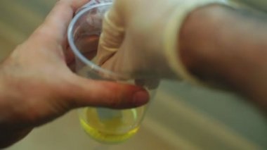 idrar örneği uyuşturucu testi 2