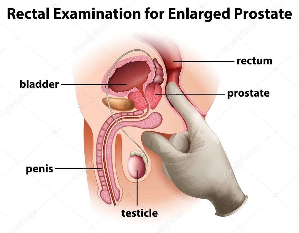 a prosztata prostat