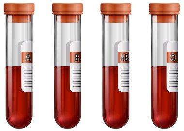 kan örnekleri ile test tüpleri