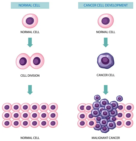 Prozess Der Entwicklung Von Krebszellen Veranschaulicht — Stockvektor