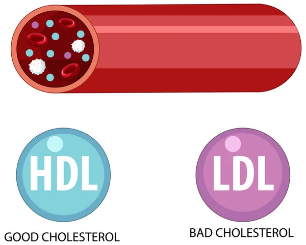 Abbildung Der Arten Von Cholesterin Hdl Und Ldl — Stockvektor