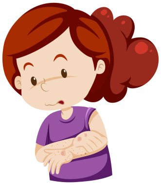 Cilt döküntüsü olan çizgi film karakteri.