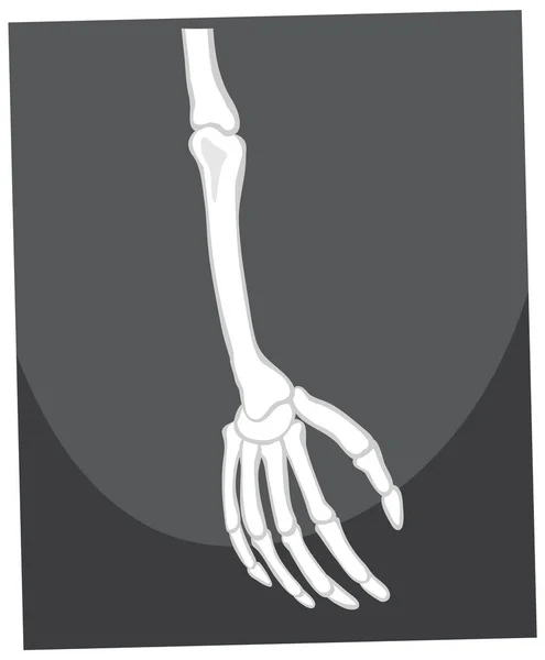 Skeleton Arm Hand Illustration — Stock Vector