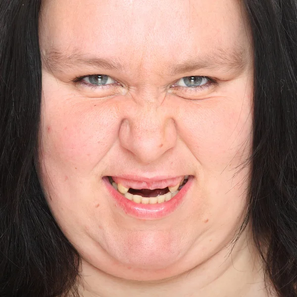 Portrait an ugly woman with missing teeth. — Stock Photo, Image