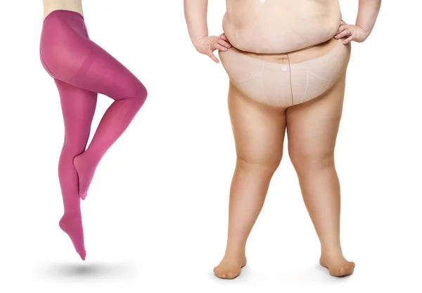 Slim and obese women in tights — Stock Photo, Image