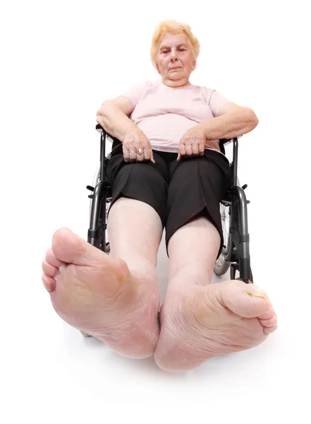 Beinkrankheit einer älteren querschnittsgelähmten Frau im Rollstuhl. — Stockfoto