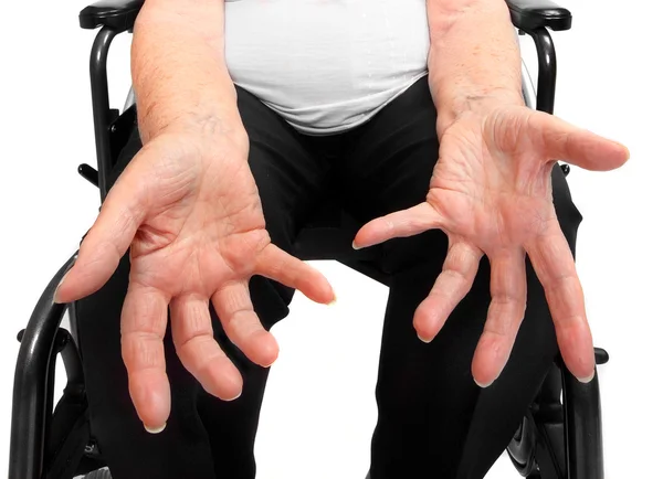 Senior women's wrinkled empty hand. Poverty metaphor. — Stock Photo, Image