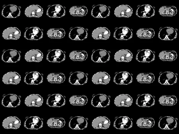 Medical x-ray background — Stock Photo, Image