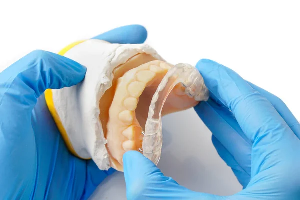 Dentist Adjusting Dental Splint Device Made Occlusion Problems Bruxism Retainer — Stock Photo, Image
