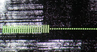 TV sesi