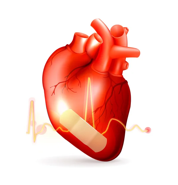 Поврежденное сердце — стоковый вектор