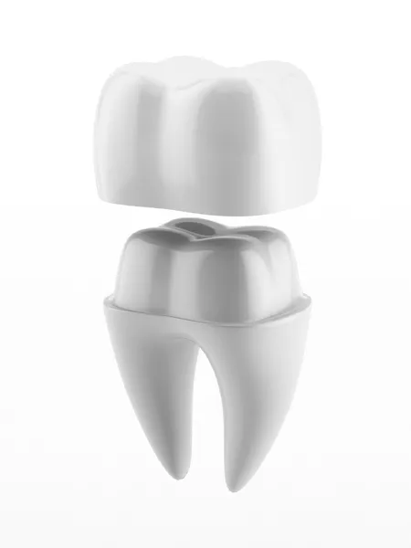 Corona dentale e dente — Foto Stock