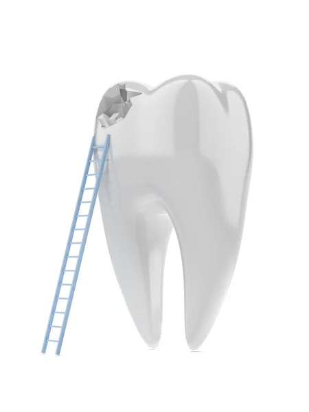 Zahn und Leiter Stockbild