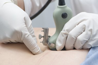 Doktor çözümlenmesi için hamile kadının karın duvarı ele alıyor.