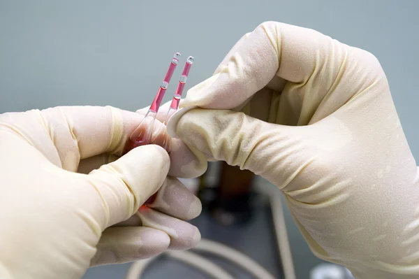 Opening of an ampoule — Stock Photo, Image