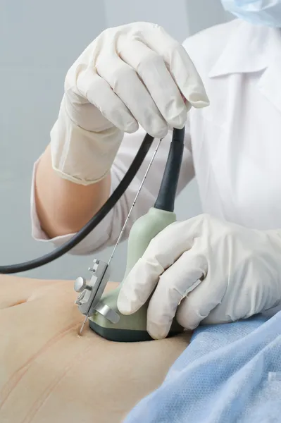 Doctor punctures abdominal wall of pregnant woman for analysis o — Stock Image Doctor punctures abdominal wall of pregnant woman for analysis o Stock Image
