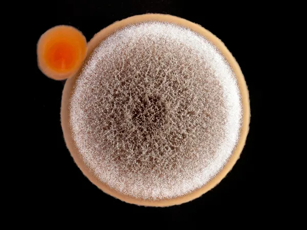 Agar kültürü