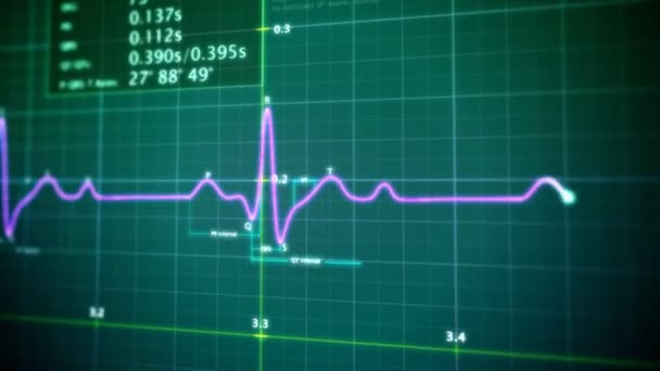 Lazo EKG — Vídeo de stock