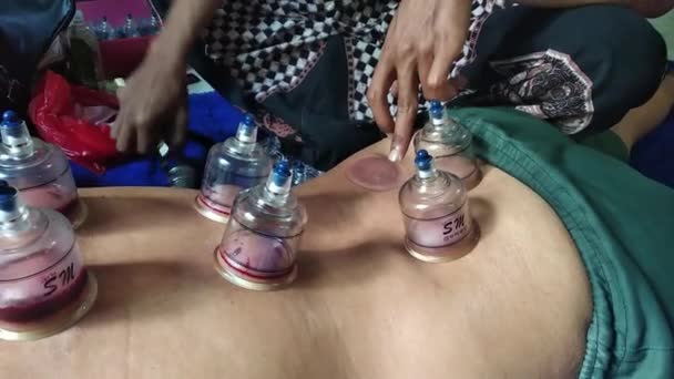 Blora Central Java Indonésie 2021 Cupping Nebo Cupping Hijamah Tradiční — Stock video