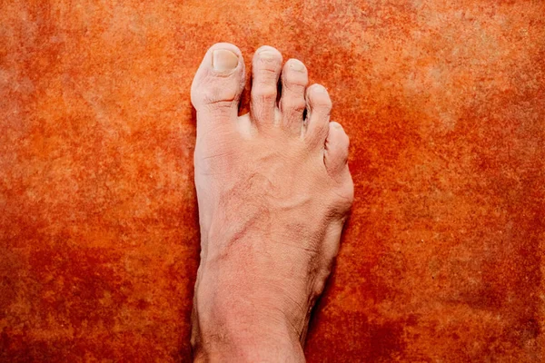 Detail Foot Swollen Humidity Skin Saturated Water Wrinkled — Stok fotoğraf