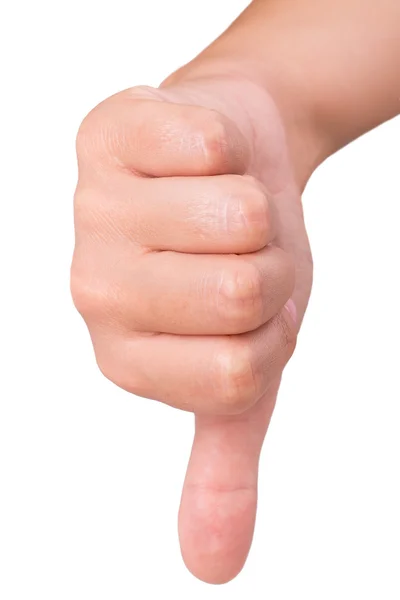 Thumbs down — Stock Photo, Image