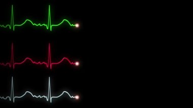 Üç ekg, EKG izlemeler