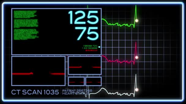 Una pantalla de computadora del hospital de ficción monitoreando un corazón humano . — Vídeos de Stock