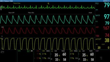 İnsan kalbi izleme kurgusal hastane bilgisayar ekranı.