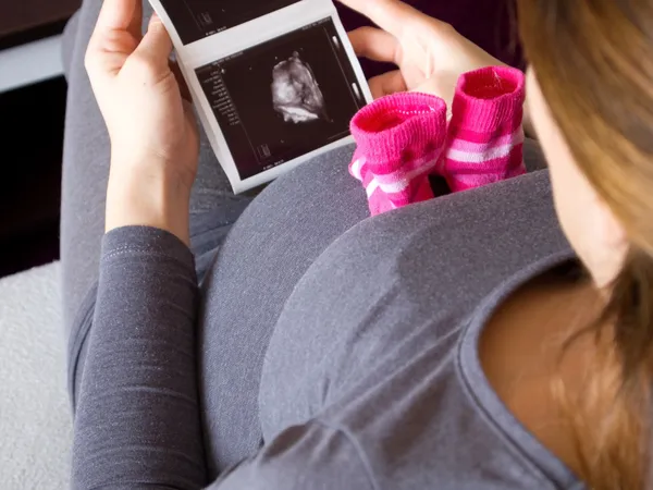超音波画像と妊娠中の女性 — ストック写真
