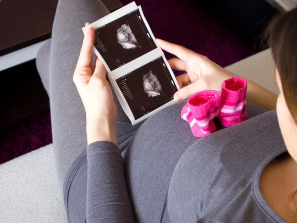 Frau sucht Ultraschallbild von Baby — Stockfoto