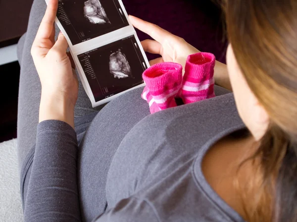 Pregnant woman and ultrasound image of baby — Stock Photo, Image