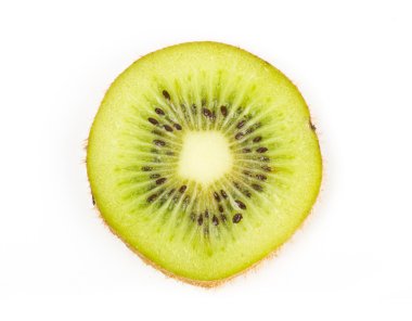 rodajas de cebolla madura sobre fondo blanco