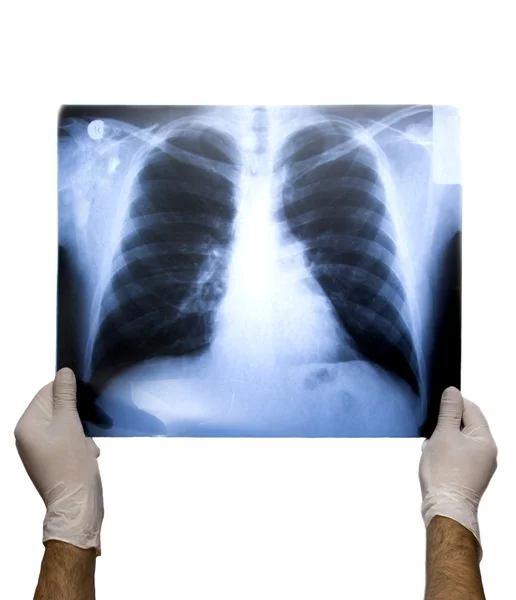 X-ray — Stock Photo, Image