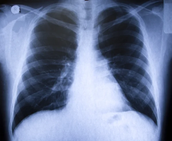 X-ray — Stock Photo, Image