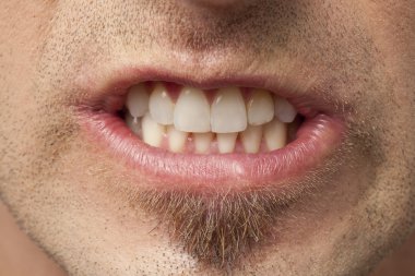 adam kızgın bir yüz