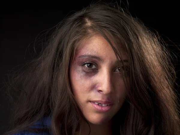 Portrait image of a abused young woman with broken teeth — Stock Photo, Image