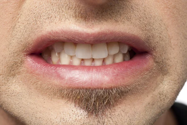 Mann beißt die Zähne zusammen oder knirscht — Stockfoto