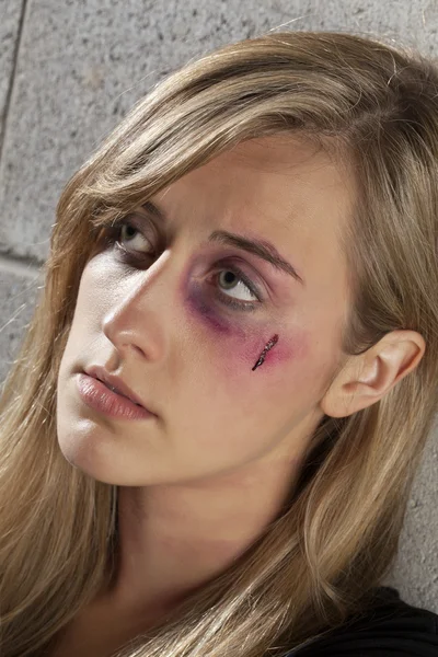 Kobiety z podbitym okiem i rany — Zdjęcie stockowe