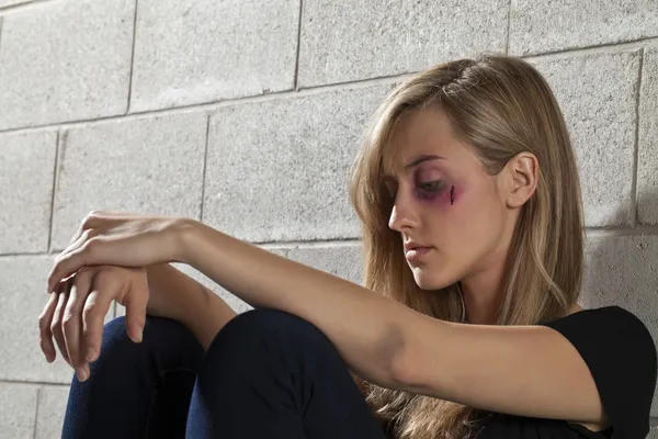 En mishandlet kvinne med blåmerker – stockfoto