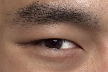 bir erkek sağ gözü