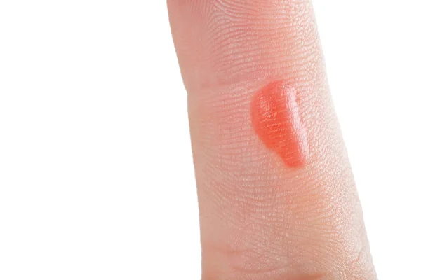 Hand Finger Red Blister Callus Workers Trauma Hard Work Inflamed — Stock Photo, Image