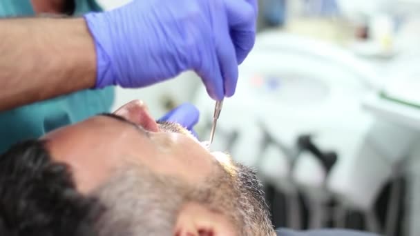 Пацієнт у стоматолога — стокове відео