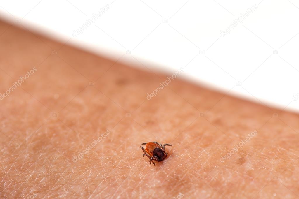 Tick on human skin